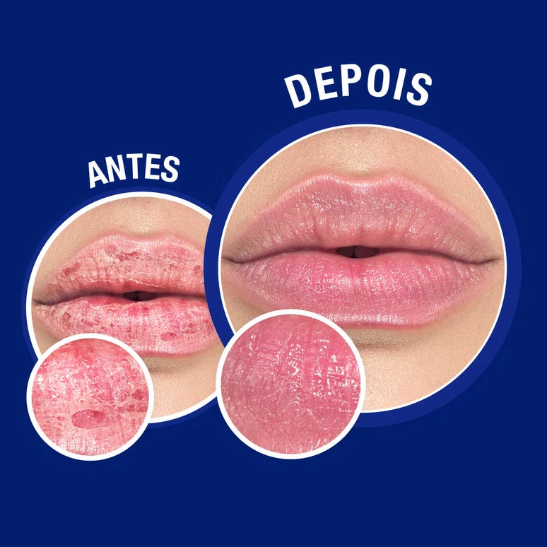 Neutrogena bálsamo labial cica reparação intensa em tubo 15ml